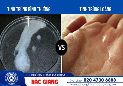 Tinh trùng loãng: Dấu hiệu