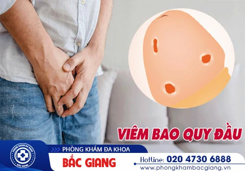 Giải pháp trị viêm bao quy đầu hiệu quả nhanh chóng