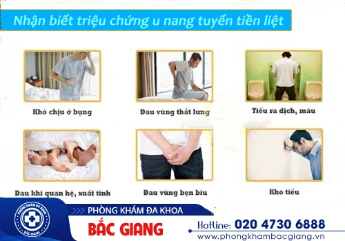 U nang tuyến tiền liệt - Căn bệnh bất kỳ nam giới nào cũng có nguy cơ mắc phải