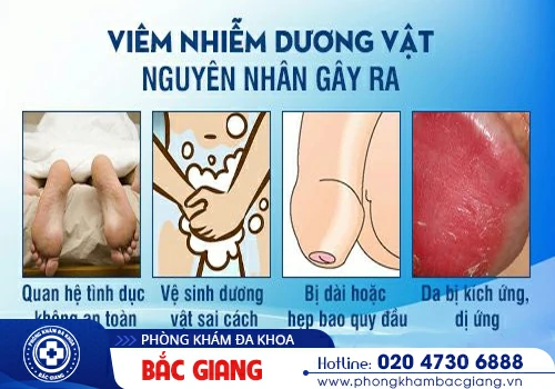 Viêm dương vật - Căn bệnh nam khoa không thể chủ quan