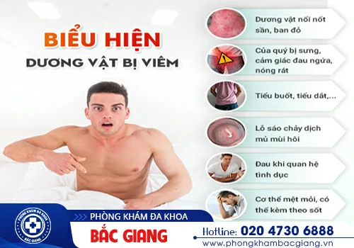 Viêm dương vật - Căn bệnh sinh dục nam không thể chủ quan