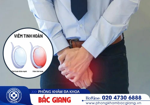 Viêm tinh hoàn là bệnh gì? Điều trị viêm tinh hoàn như thế nào?