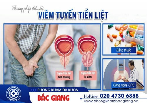 Giải pháp chữa viêm tuyến tiền liệt, ngăn ngừa kịp thời biến chứng