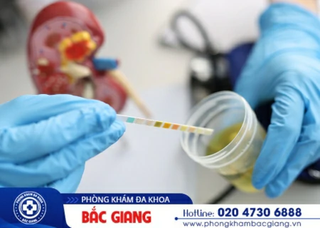 Phương pháp xét nghiệm chẩn đoán viêm đường tiết niệu là gì?