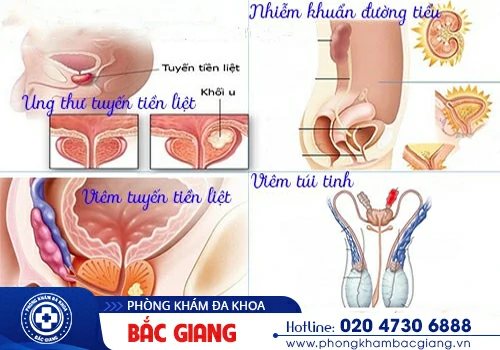 Tại sao nam giới xuất tinh bị đau buốt?