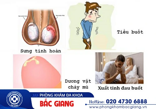 Tại sao nam giới xuất tinh bị đau buốt?