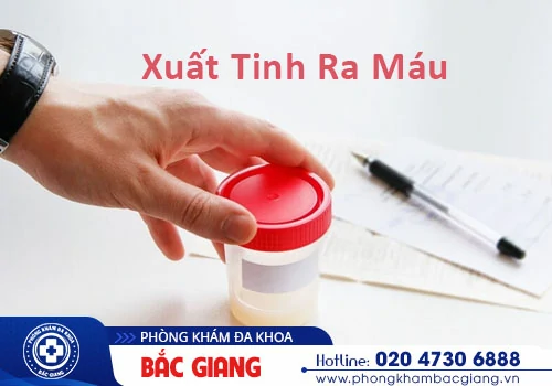 Cẩn trọng với triệu chứng xuất tinh ra máu